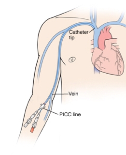 ImageUploadedByallnurses1446620415.786379.jpg.c10bf1749eee0fad8bbef0d480ebd0c2.jpg