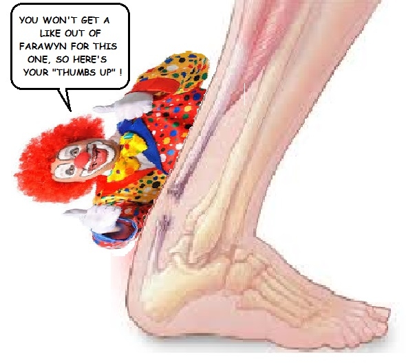 710462622_achilliestendonclown.jpg.b471336629edca86345a60a4e228c3bc.jpg