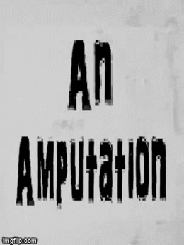 amputation.gif.9edf6e0800640c3166210bd85e2a8d63.gif