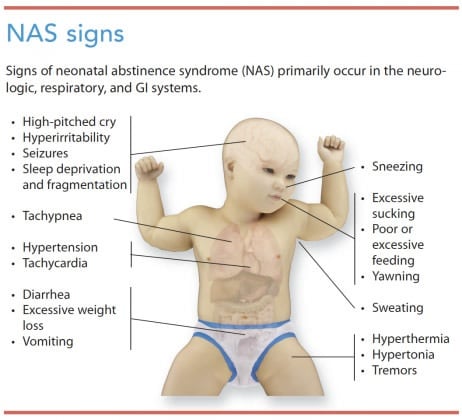 neonatal-abstinence-syndrome.jpg.6c761e9e527dec4fc44f9c196d5d2708.jpg