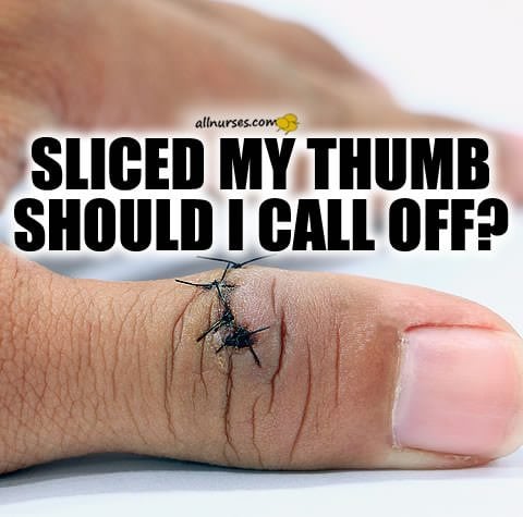 cut-thumb-stitches-nurse-call-off.jpg.a2847d84f30945833070228f50548bd9.jpg