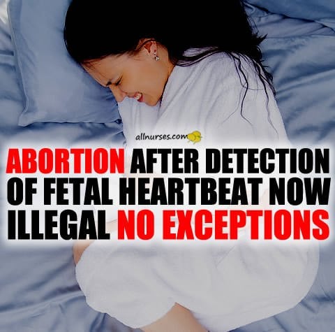 nurses-abortion-after-heartbeat-detection-illegal-no-exceptions.jpg.c62a4e7423b1116ed569ab1a14736825.jpg