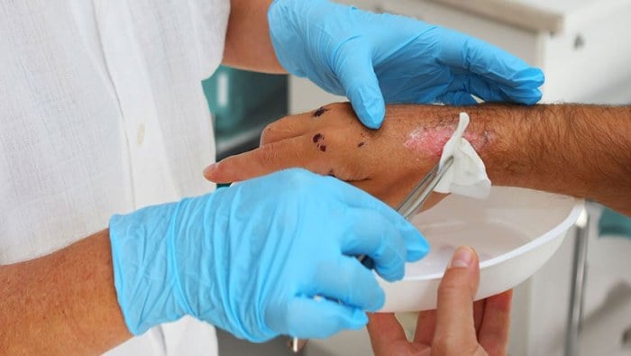 Nurse Treating Hand Wound