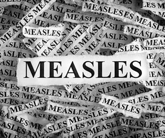 What is a nurses' response to the measles outbreak?