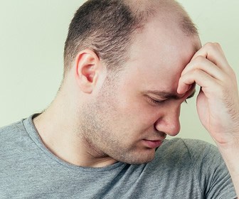 Are balding men at higher risk for COVID-19 complications?  