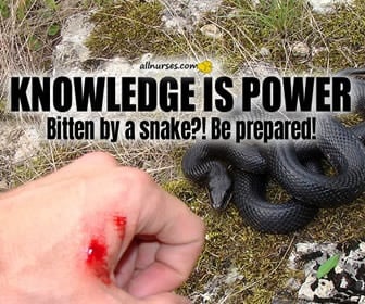 Venomous Snake Bites: Here's What To Do