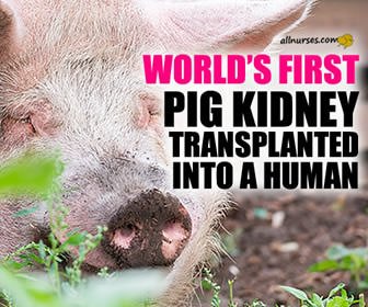 World's First Genetically Edited Pig Kidney Transplanted Into A Human