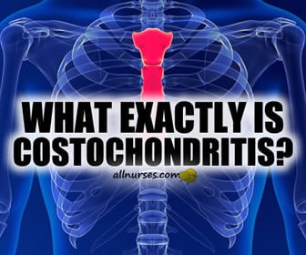 Costochondritis