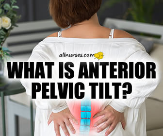 Lower Back Pain and Anterior Pelvic Tilt