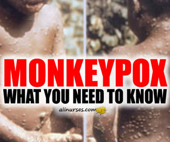 Monkeypox Going Viral! What You Need To Know