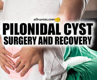 After repeat appearances, The Pilonidal Abscess needs to stay gone!