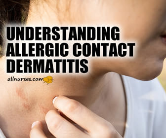 Understanding Contact Dermatitis and the Allergens You are Missing