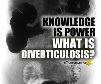 What is Diverticulosis?