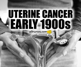 Uterine Cancer Then and Now