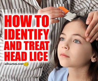 How To Identify And Treat Head Lice