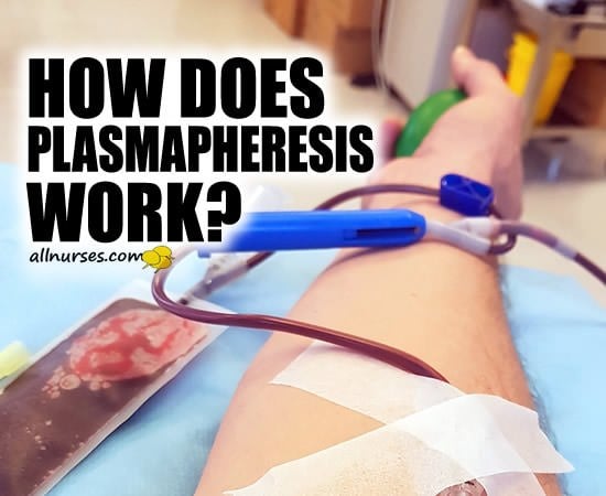 How does plasmapheresis work?