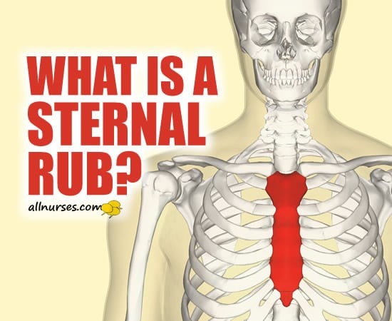 What is a Sternal Rub?